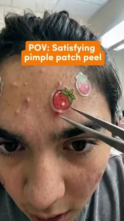 Just for Teens on Coverstar, video from Jun 27: Who’s watching this more than once? 😌💙 #JustForTeens #PimplePatch #OddlySatisfying #SkincareTok #TeenSkincare